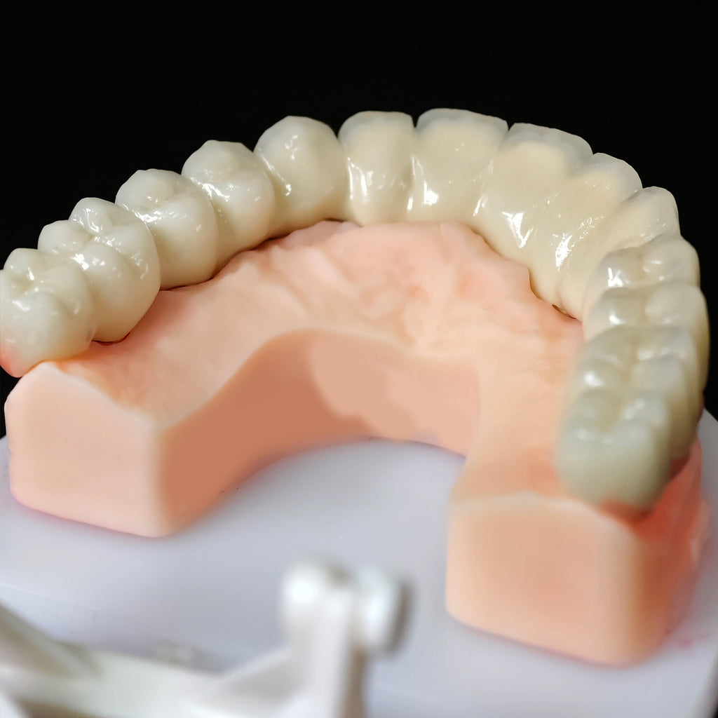 Co - Cr PFM Dental Bridge