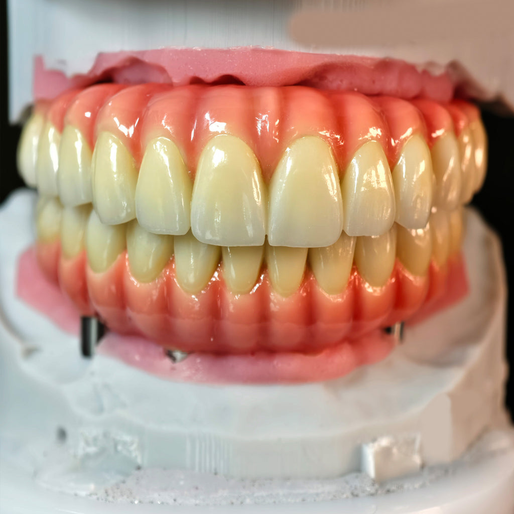 Enhanced Zirconia Crown Malo Bridge