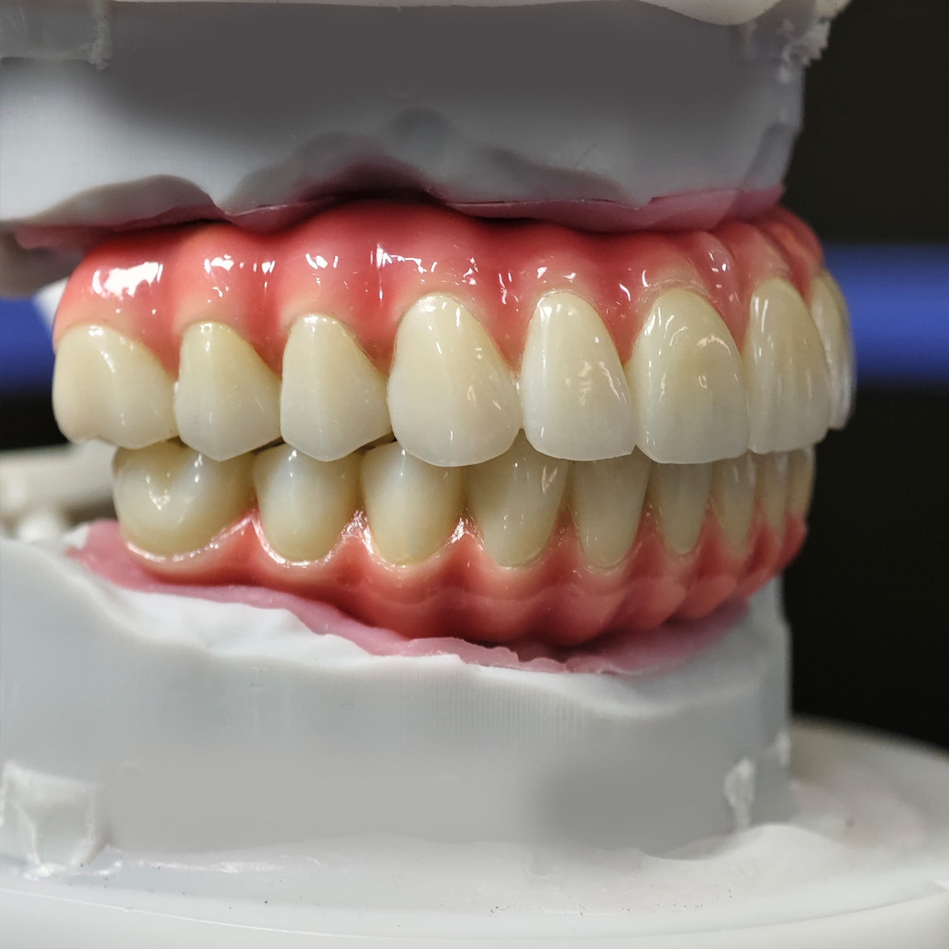 Enhanced Zirconia Crown Malo Bridge