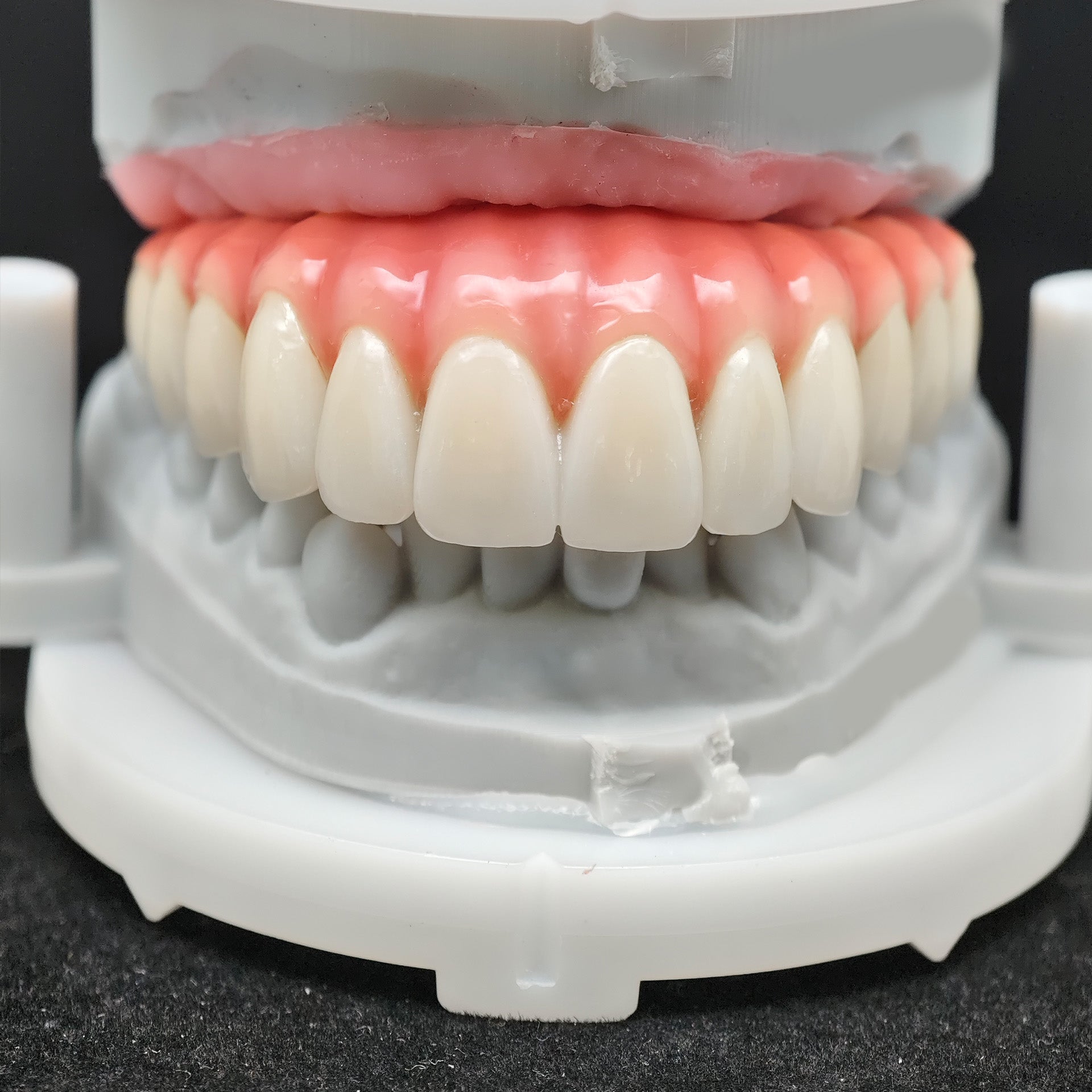 Enhanced Zirconia Crown Malo Bridge