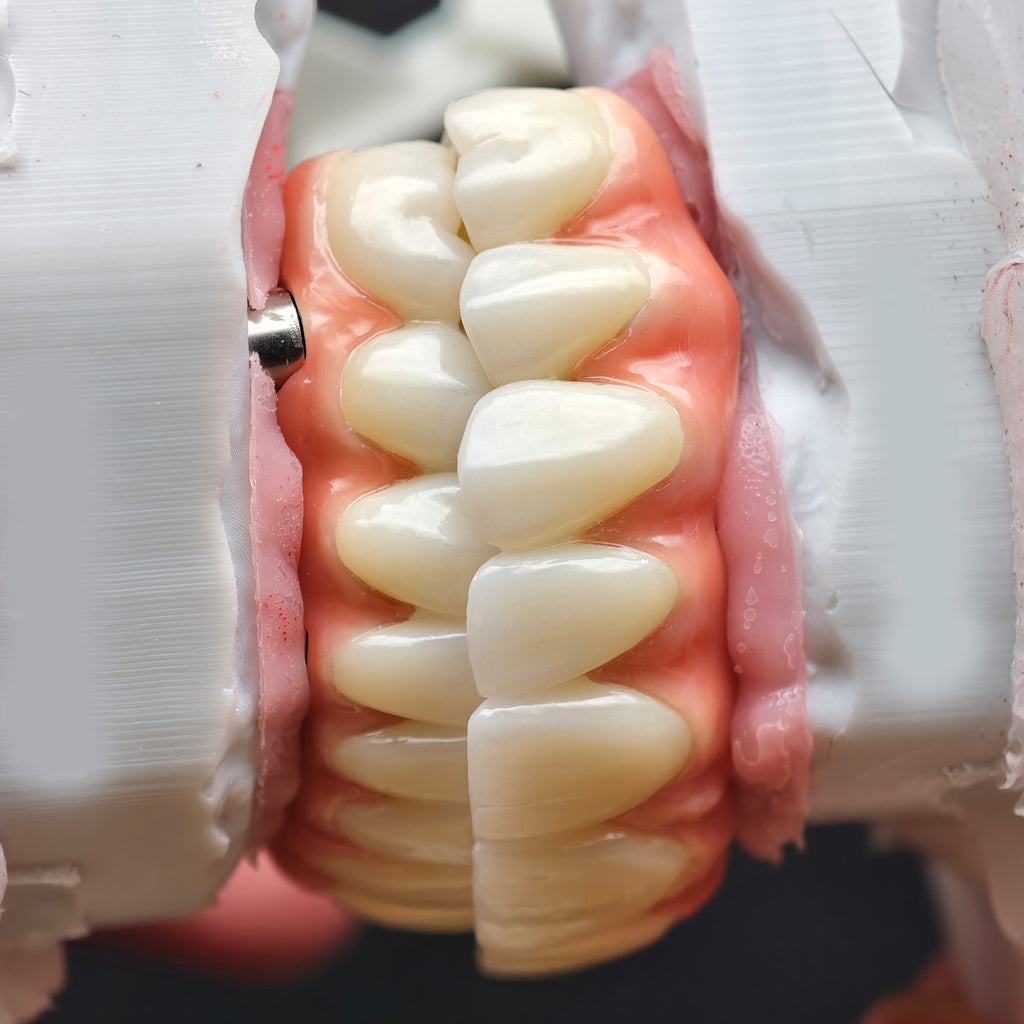 Enhanced Zirconia Crown Malo Bridge