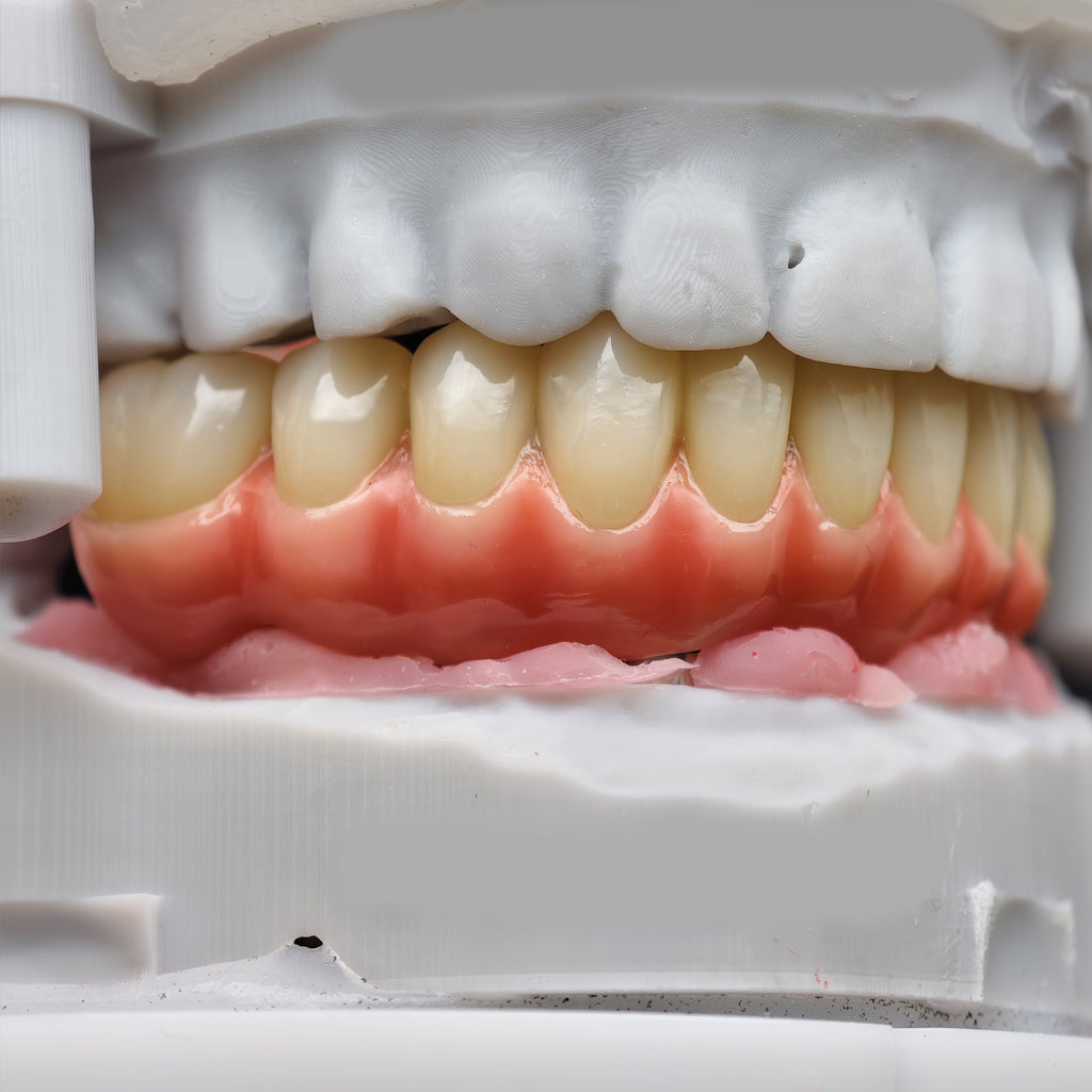 Enhanced Zirconia Crown Malo Bridge