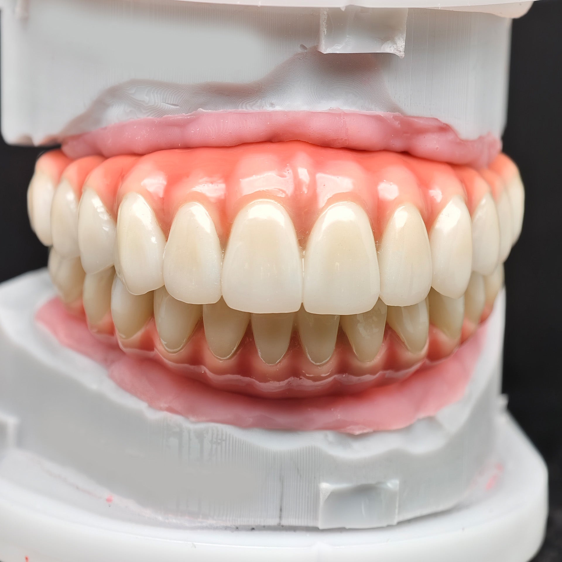 Enhanced Zirconia Crown Malo Bridge
