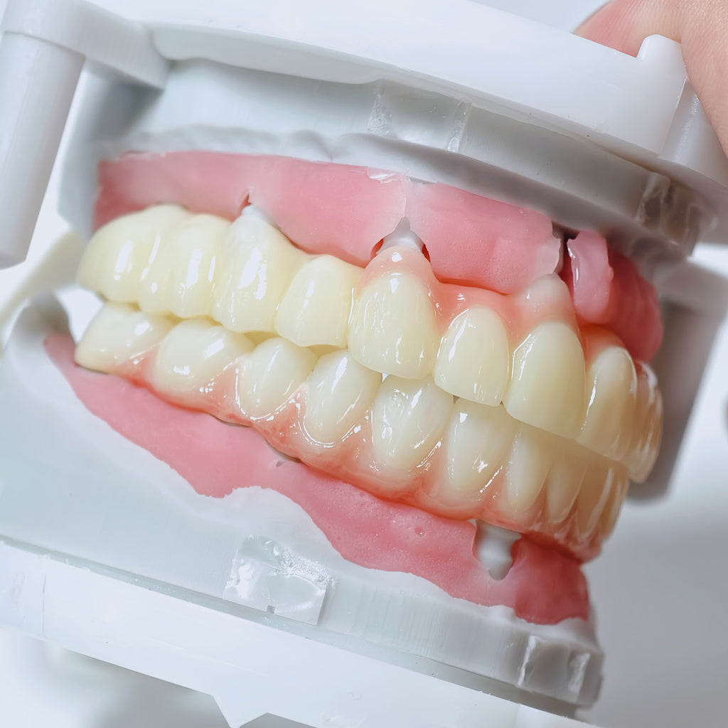 Full-Arch Zirconia Bridge And PMMA Bridge With Cement Retained