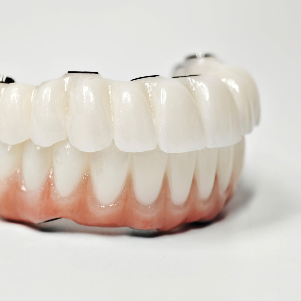 Full-Arch Zirconia Bridge With Ti-Base Abutment