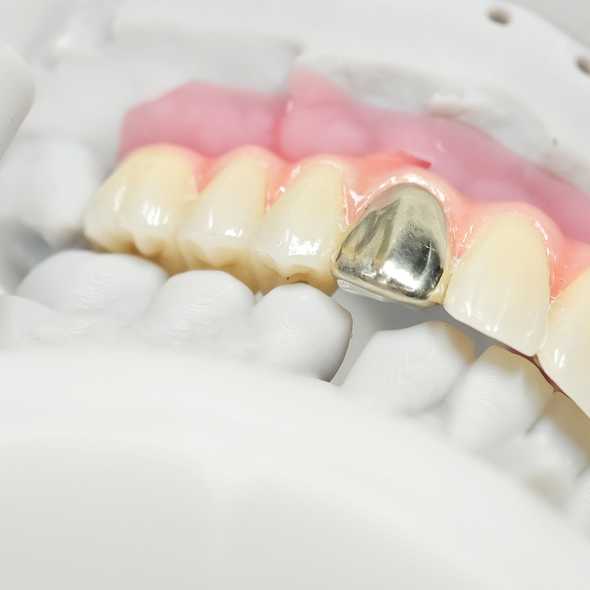 Malo Bridge With Gold-Plated Titanium Framework And A Gold Crown