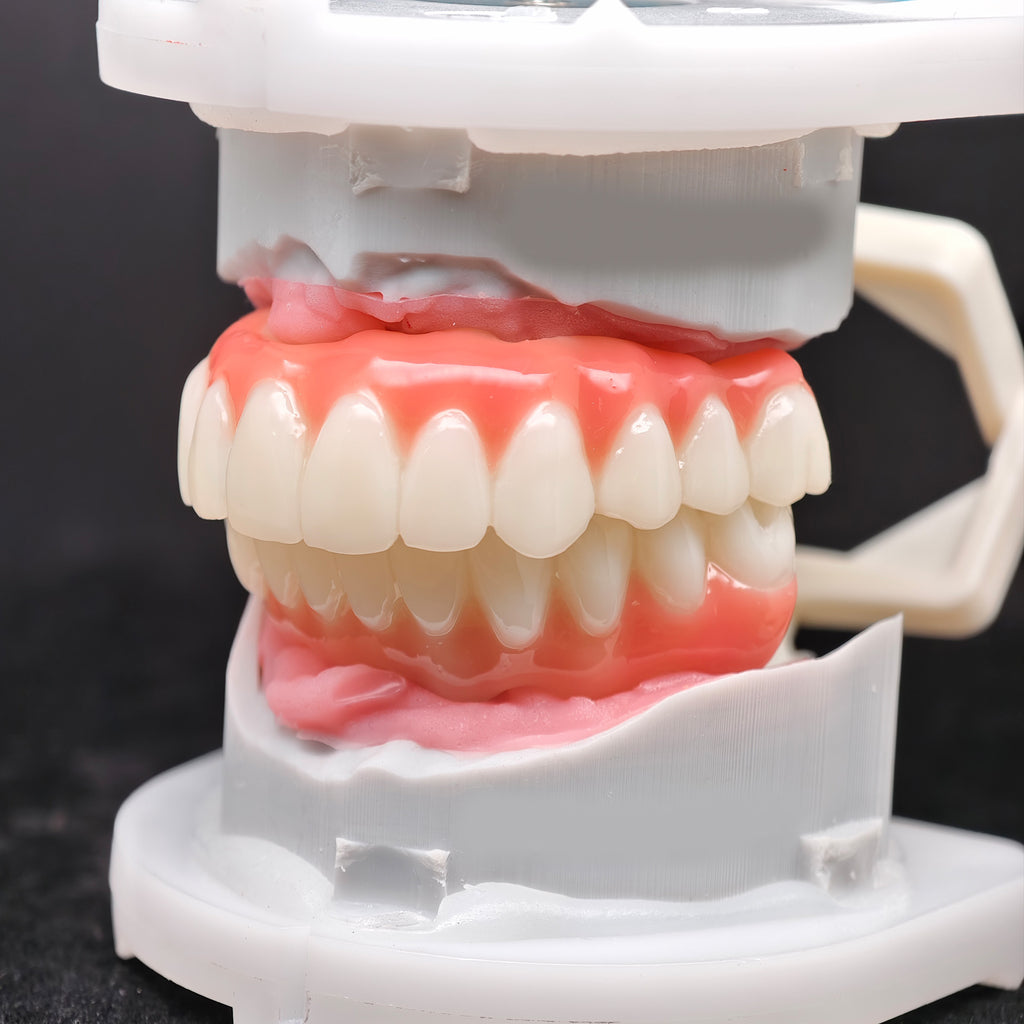 PMMA Bridge With Ti-Base Screw Retained Trying For Full Arch Restoration