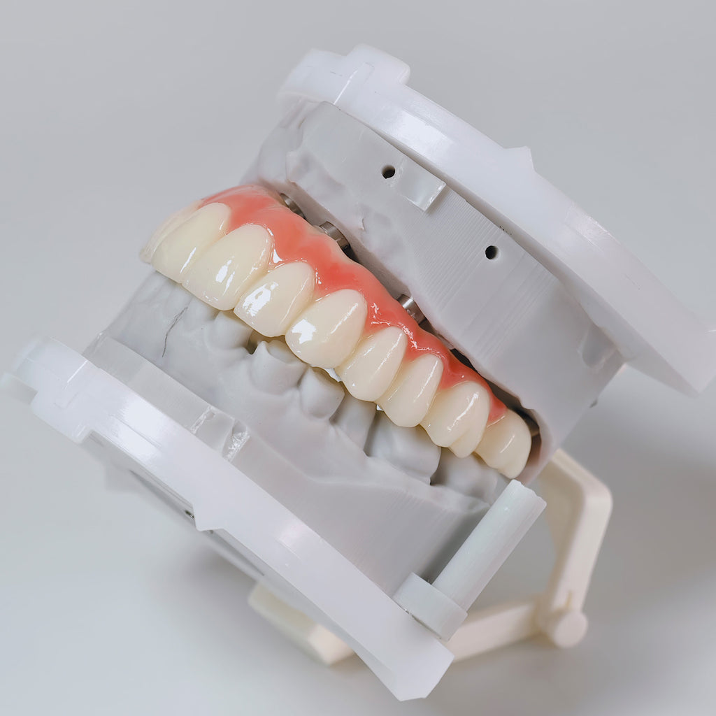 PMMA Bridge With Screw Retained