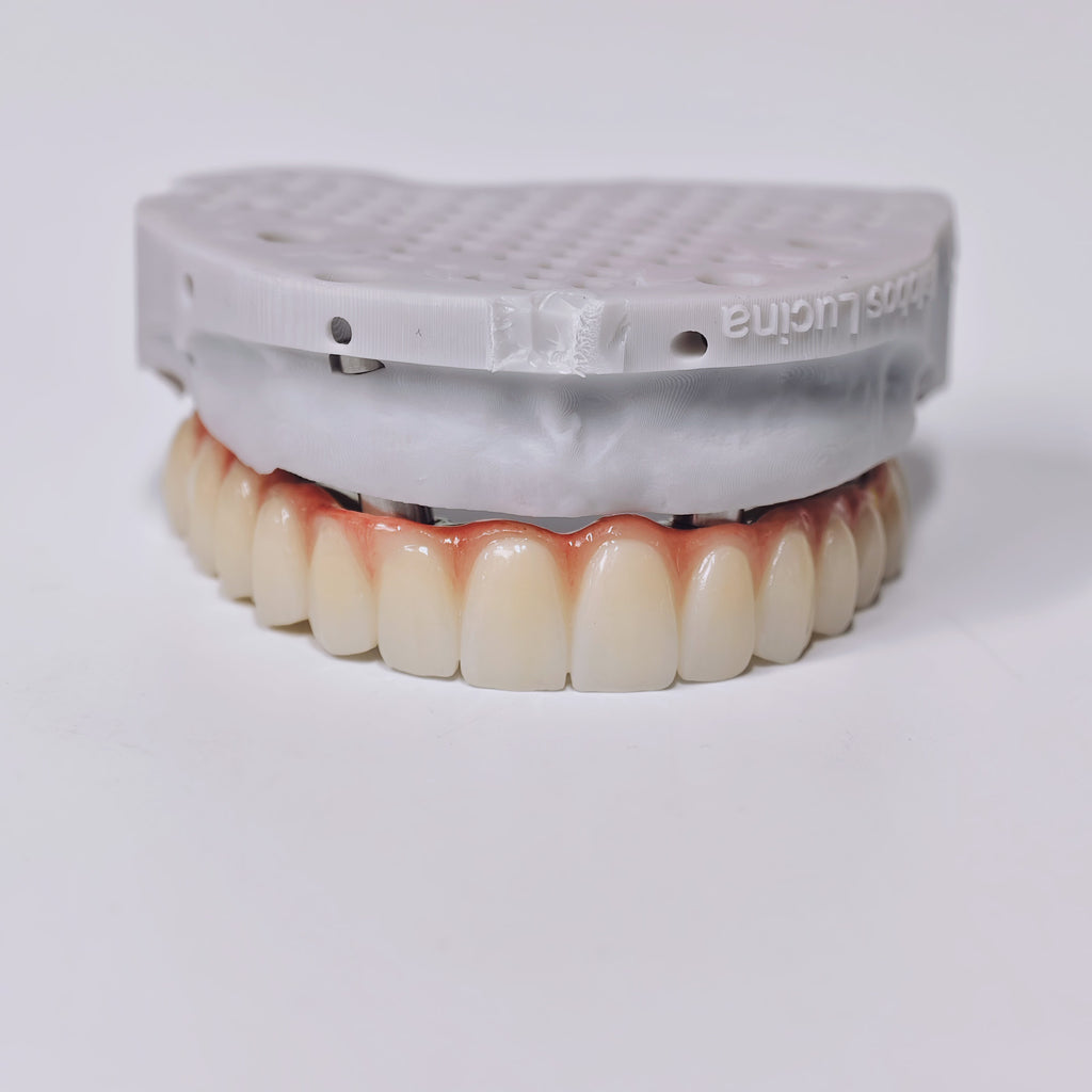 Ti-Bar Titanium Gold-Plated Metal Frame With Zirconia Bridge And Screw Retained