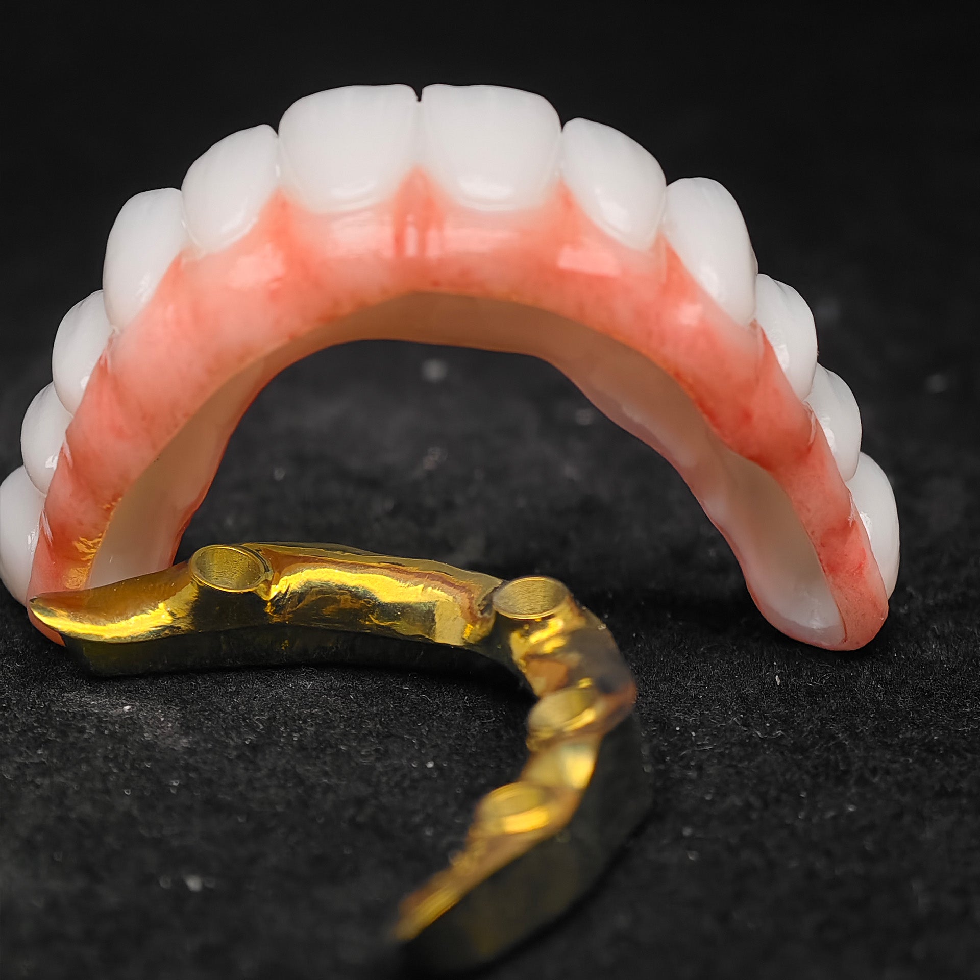 Ti-Bar Titanium Nitride Metal Frame With Zirconia Bridge For Full Arch Restoration