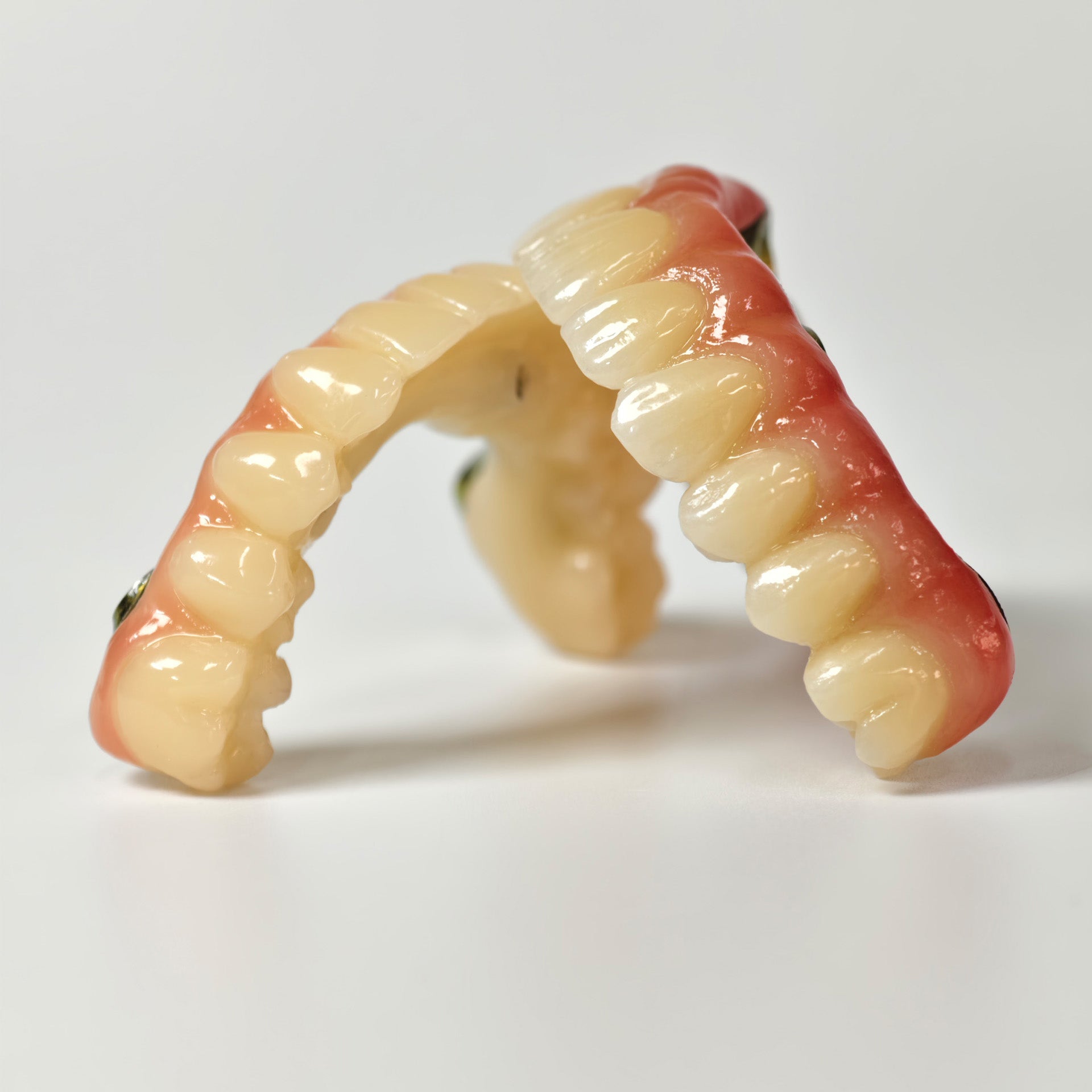 Ti-Bar Titanium Nitride Metal Frame With Zirconia Bridge For Full Arch Restoration