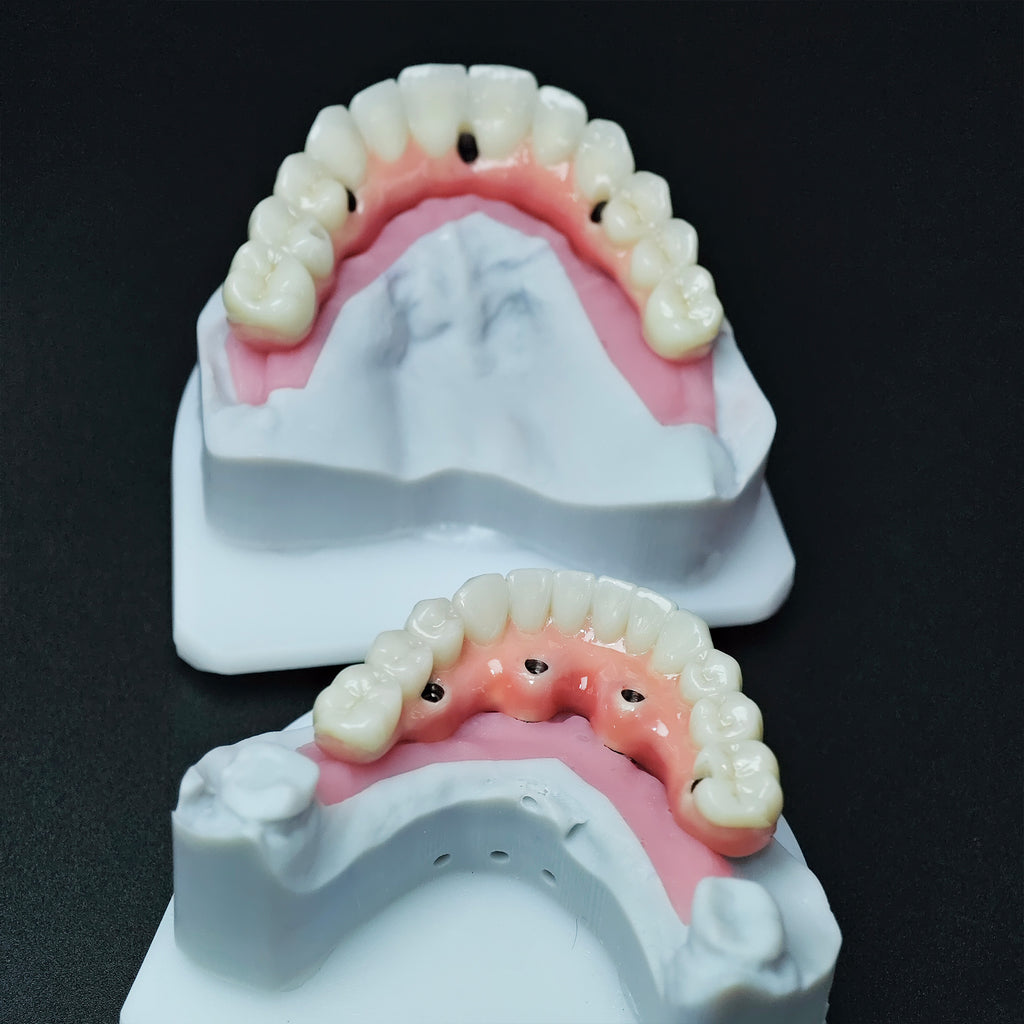Zirconia-Enamel Hybrid Malo Bridge
