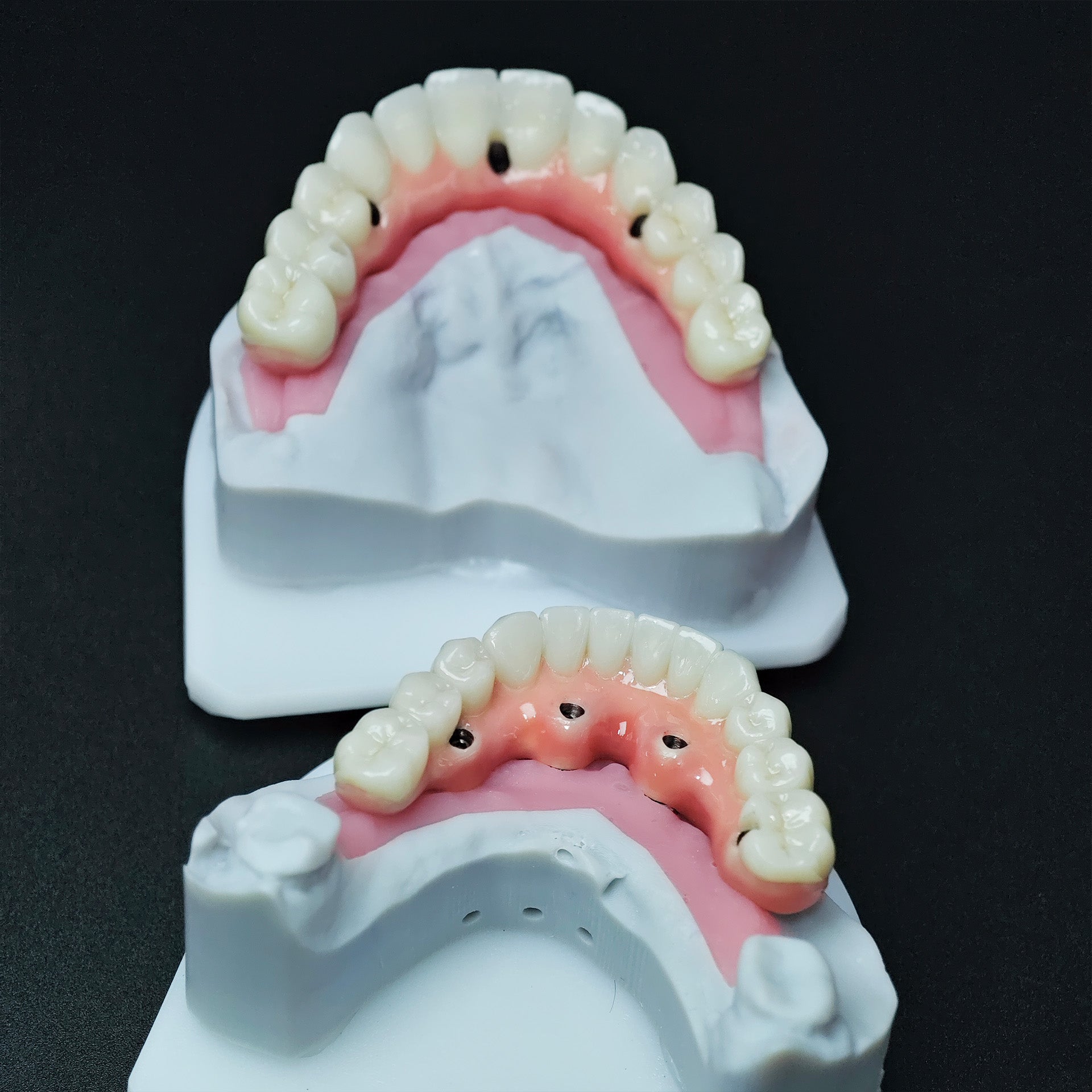 Zirconia-Enamel Hybrid Malo Bridge