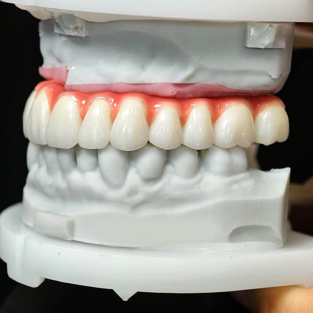 Zirconia-Enamel Hybrid Malo Bridge