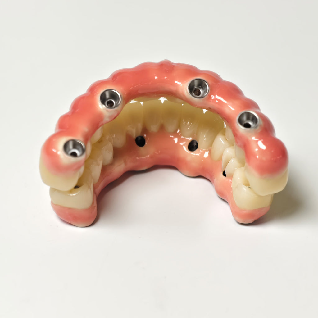 Zirconia-Enamel Hybrid Malo Bridge