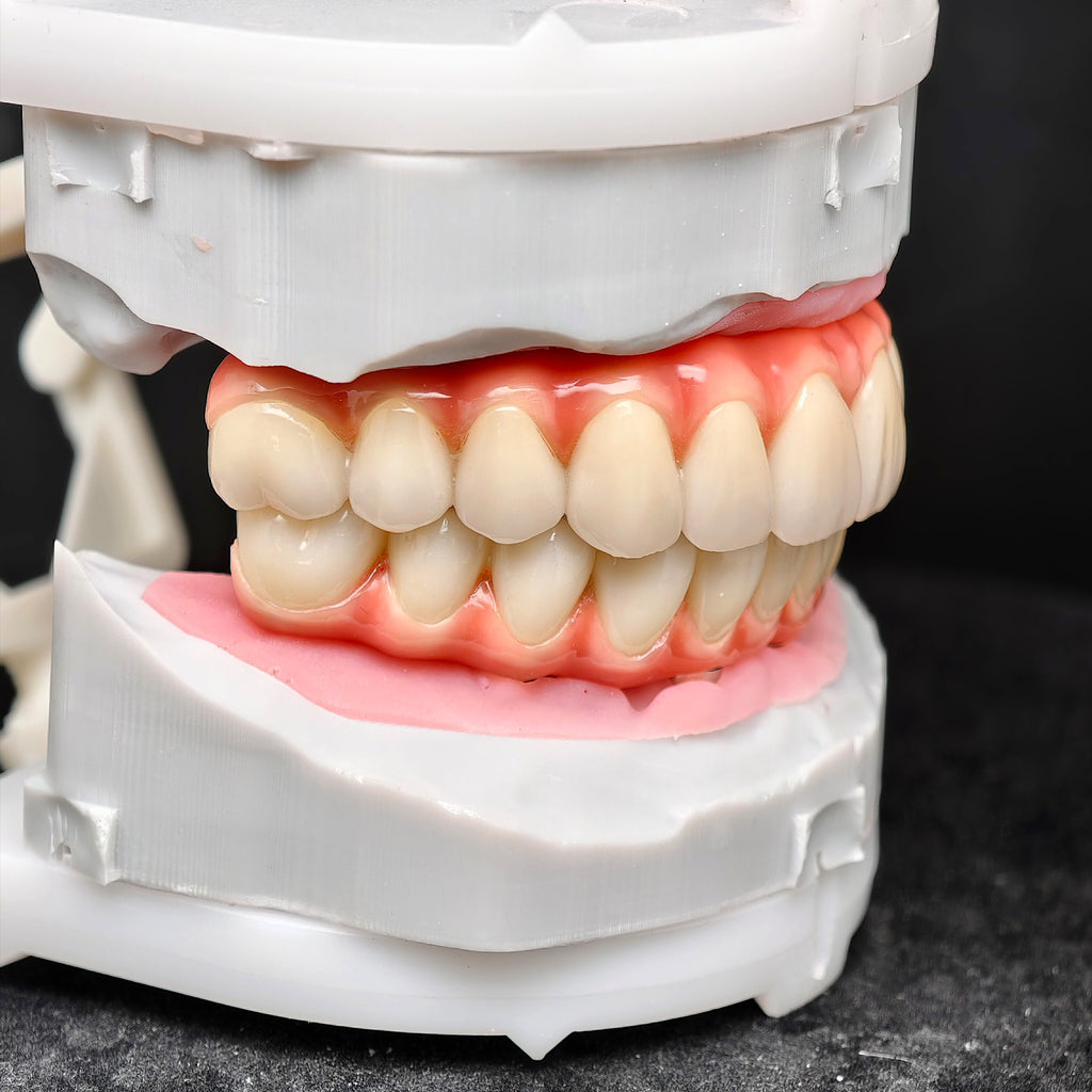 Zirconia-Enamel Hybrid Malo Bridge