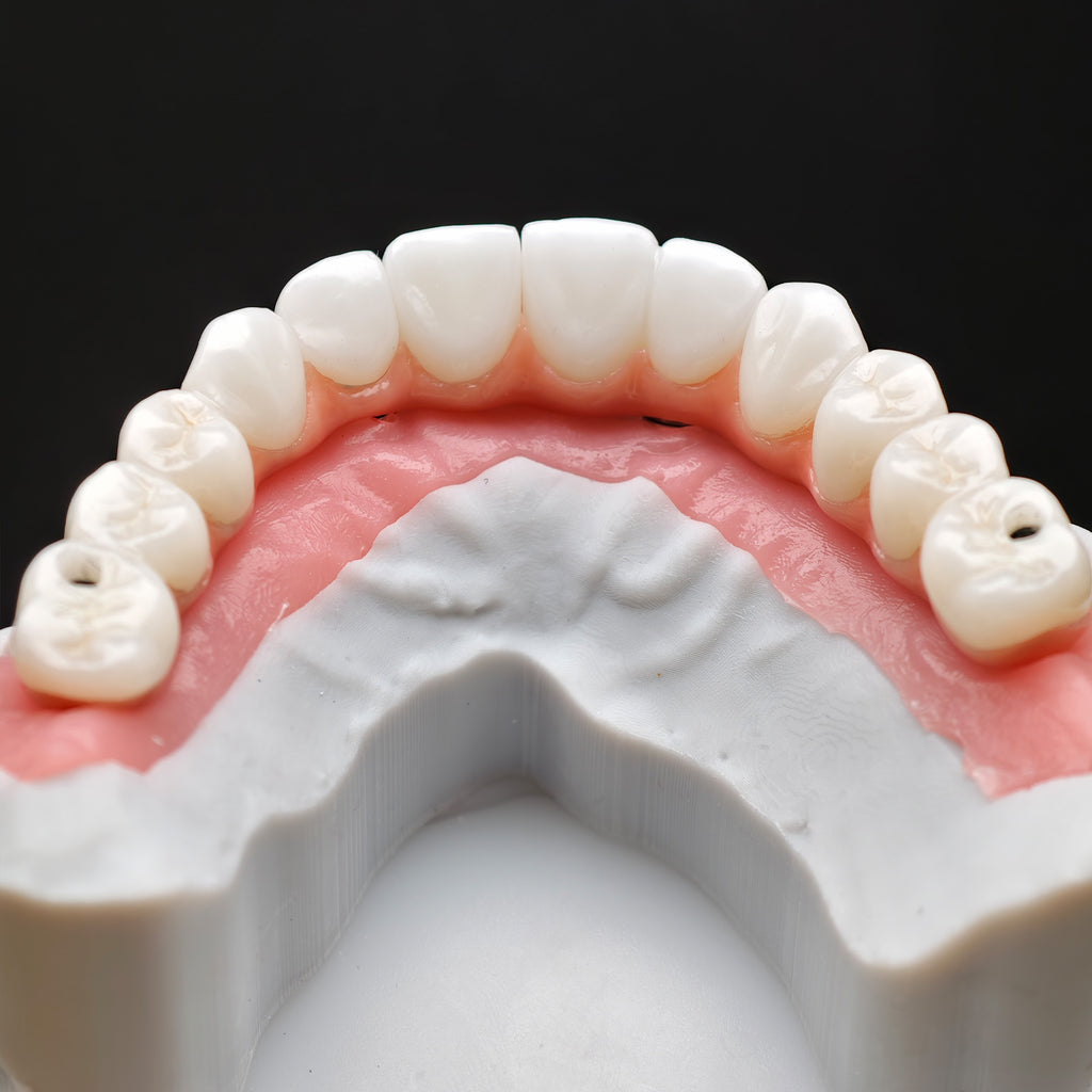 Zirconia-Enamel Hybrid Malo Bridge