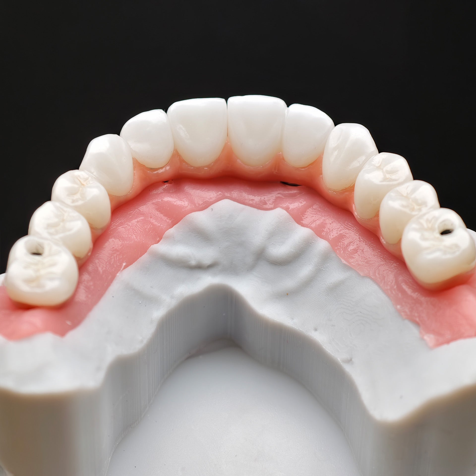 Zirconia-Enamel Hybrid Malo Bridge