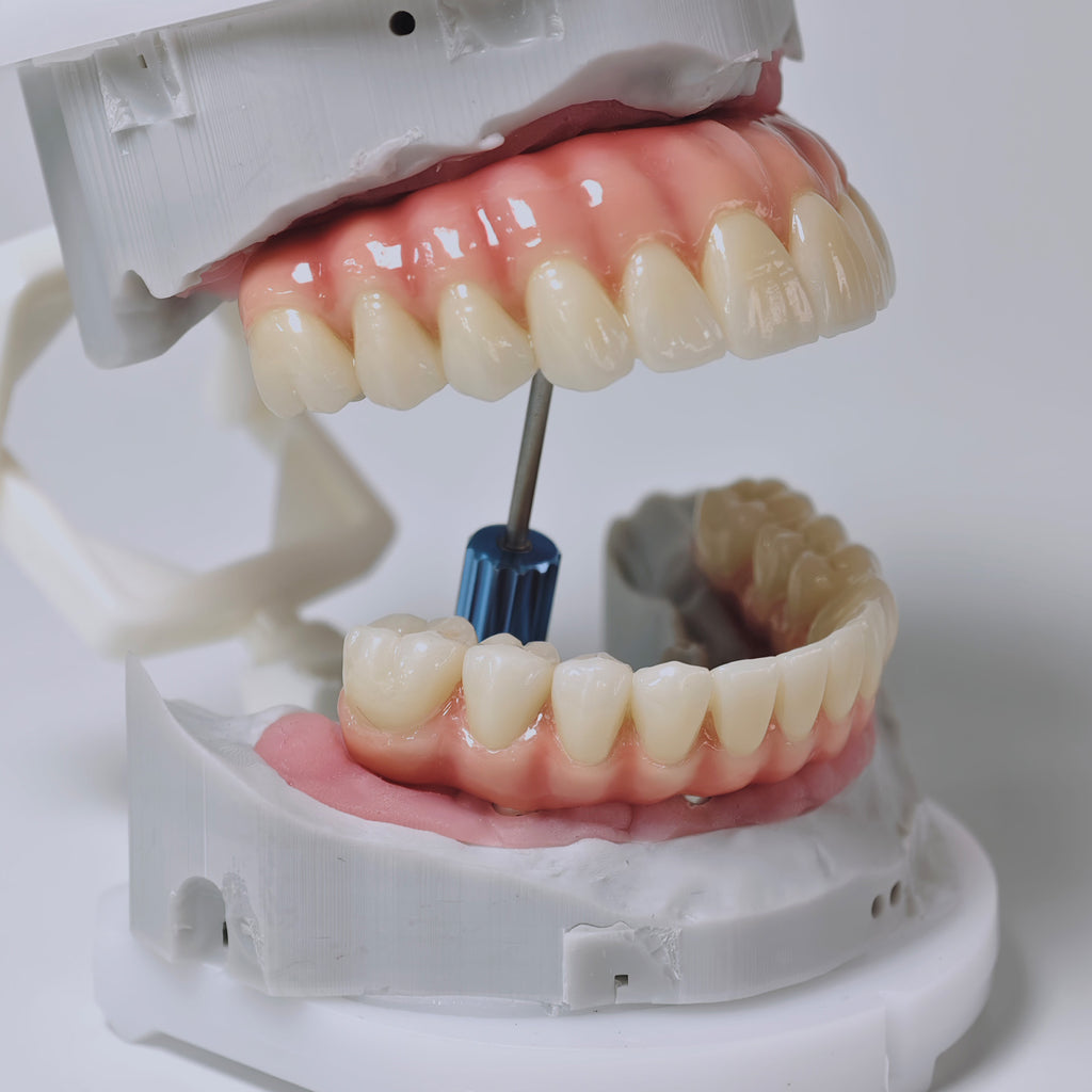 Zirconia-Enamel Hybrid Malo Bridge