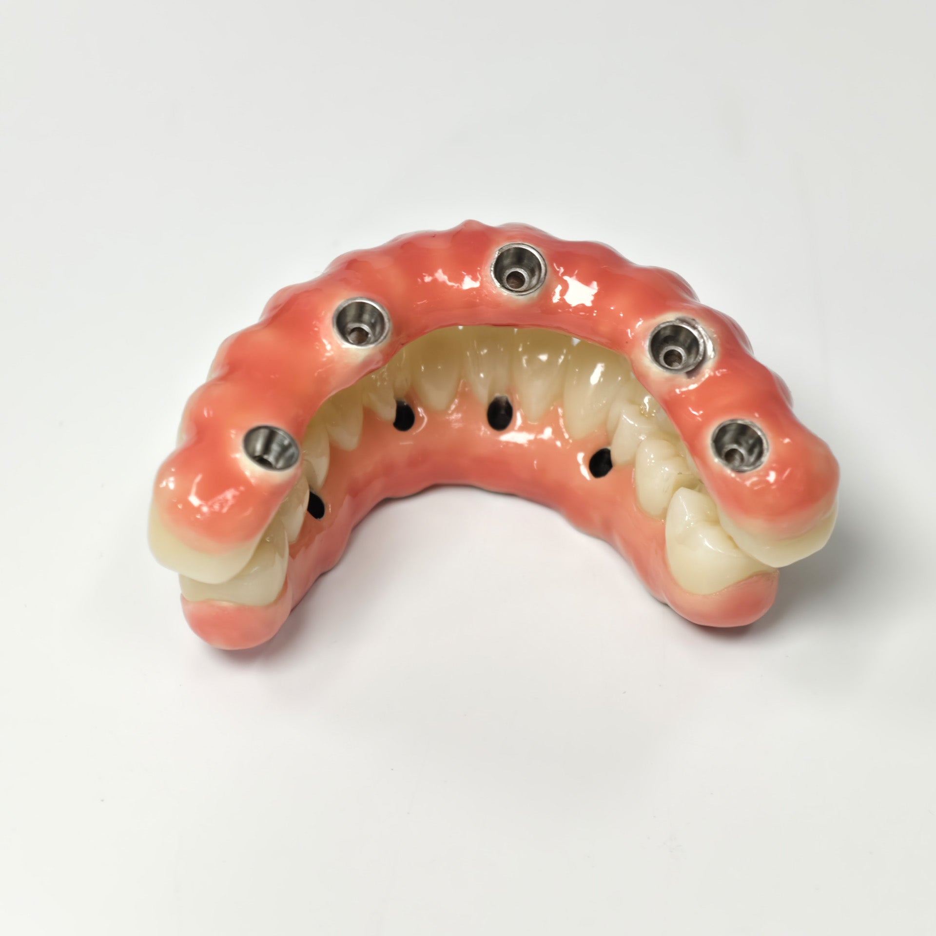 Zirconia-Enamel Hybrid Malo Bridge