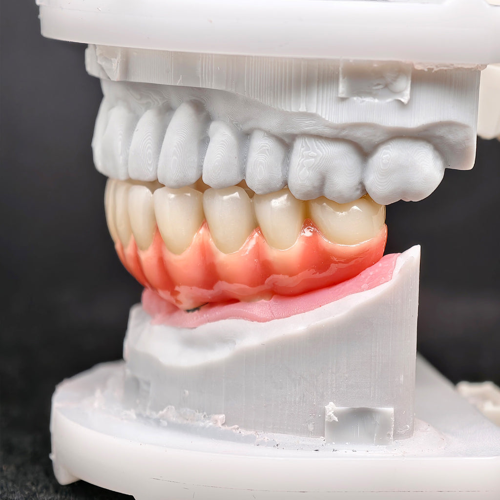 Zirconia-Enamel Hybrid Malo Bridge