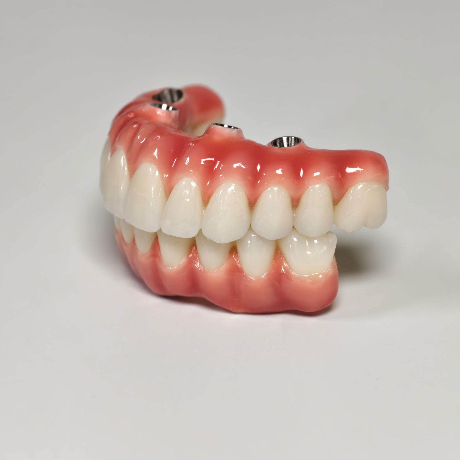 Zirconia-Enamel Hybrid Malo Bridge