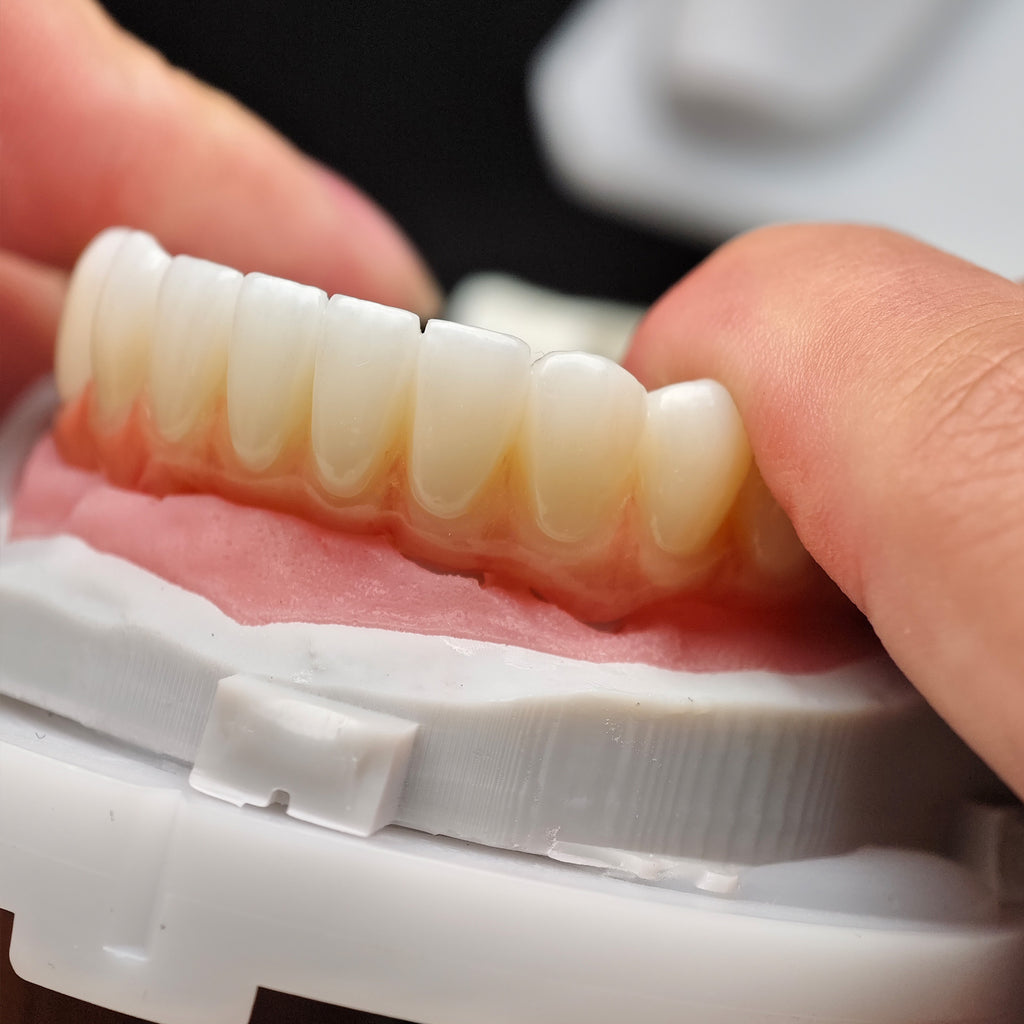 Zirconia Bridge With Cement Retained