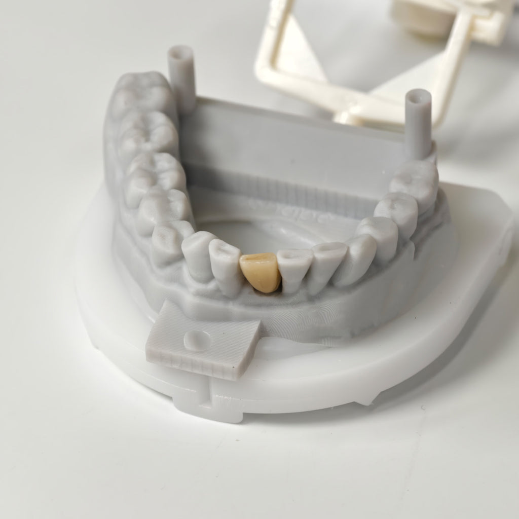 Zirconia Implant Bridge Screwmentable Dental Crown
