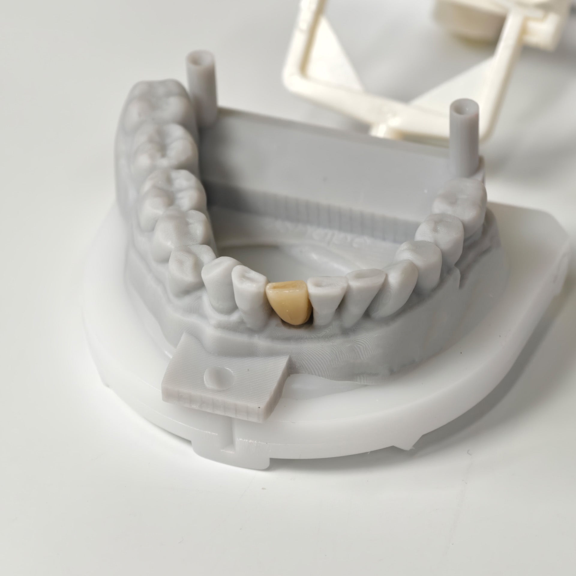Zirconia Implant Bridge Screwmentable Dental Crown