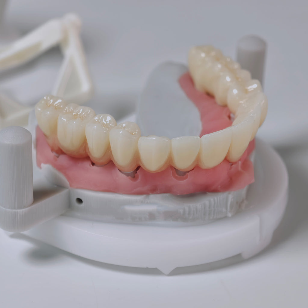 Zirconia Implant Bridges Screwmentable Dental Crown