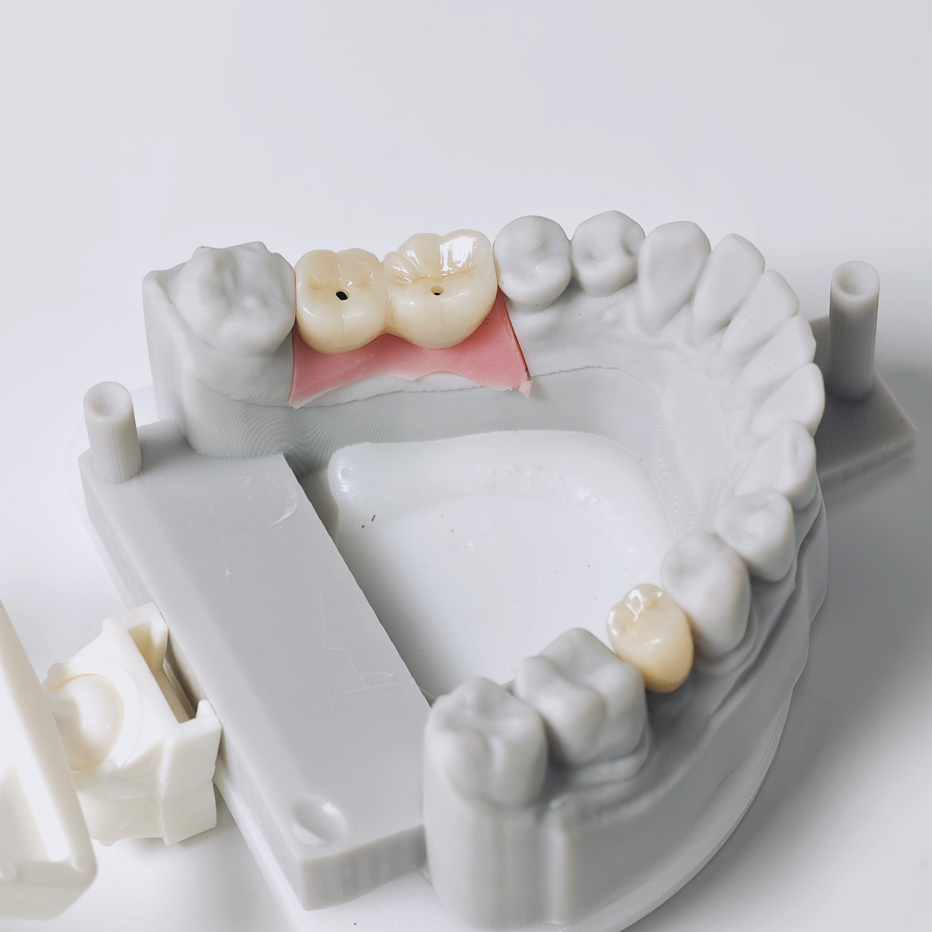 Zirconia Implant Crowns And Bridges Screwmentable Dental Crown