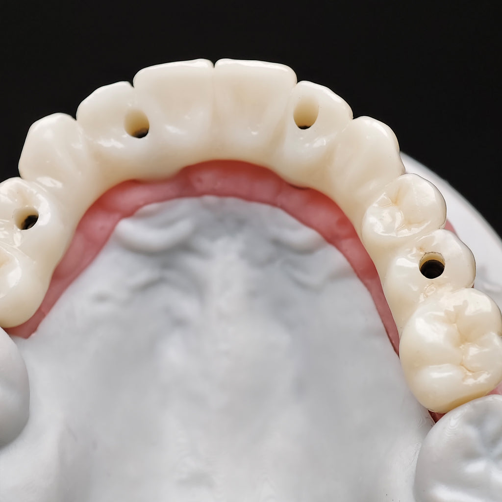 All On 4 Zirconia Bridge With Ti-Base Screw Retained Trying For Full Arch Restoration