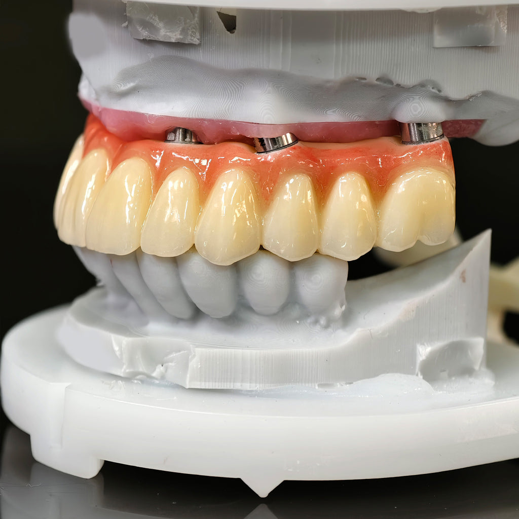 All On 5 Zirconia Bridge With Ti-Base Screw Retained Trying For Full Arch Restoration