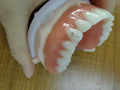 Customized Full Acrylic Denture Add Jewelry Affordable Economical Denture