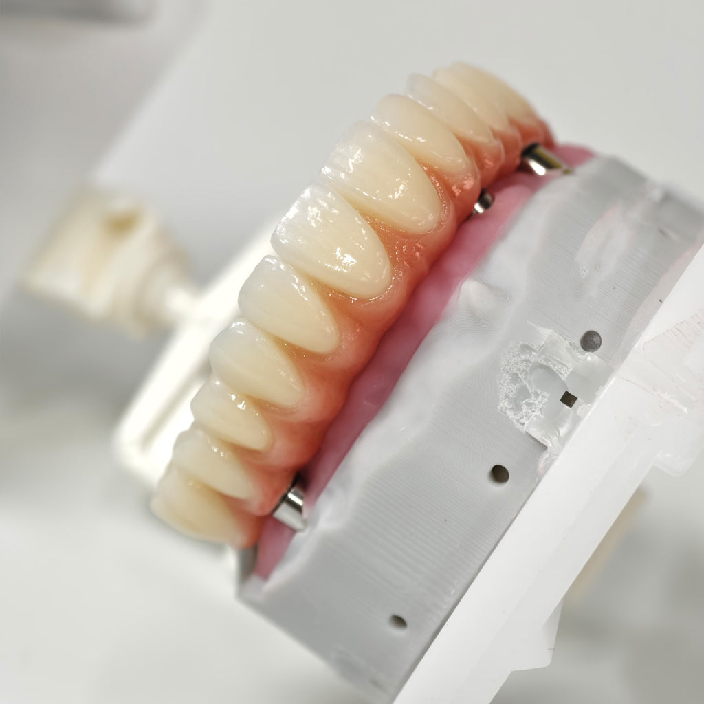 All On 5 Zirconia Bridge With Ti-Base Screw Retained