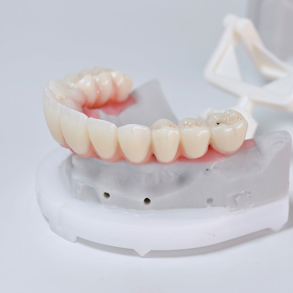 All On 6 Zirconia Bridge With Ti-Base Screw Retained