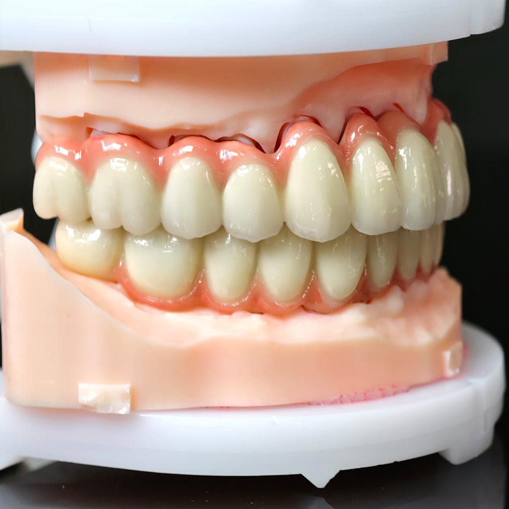 Co - Cr PFM Dental Bridge