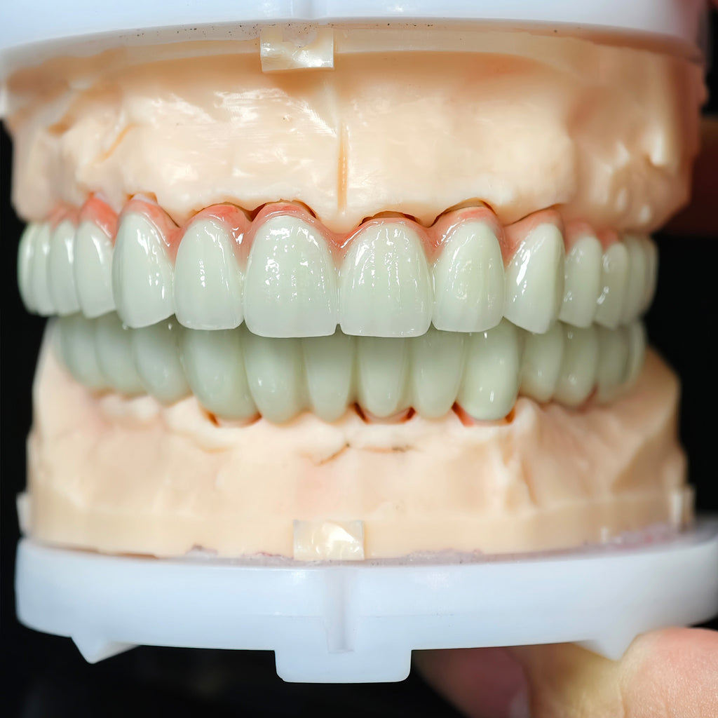 Co - Cr PFM Dental Bridge
