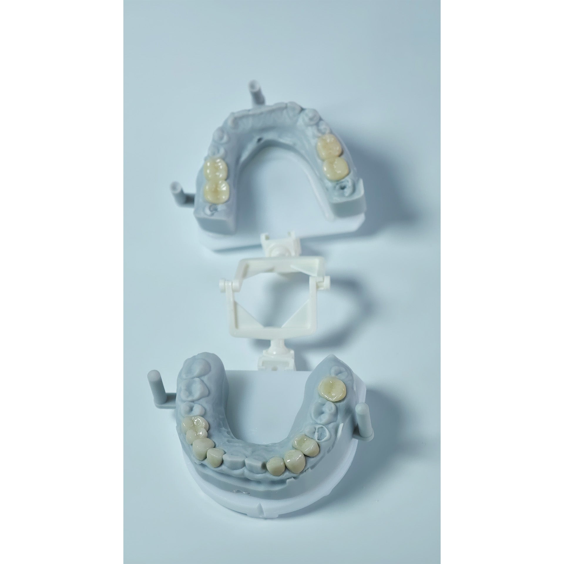 Co - Cr PFM Dental Crowns With Metal Post-And-Core