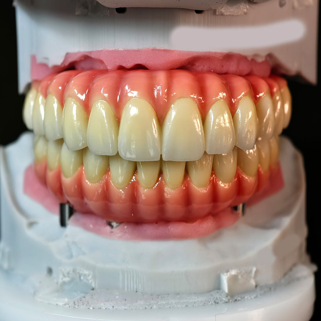Enhanced Zirconia Crown Malo Bridge
