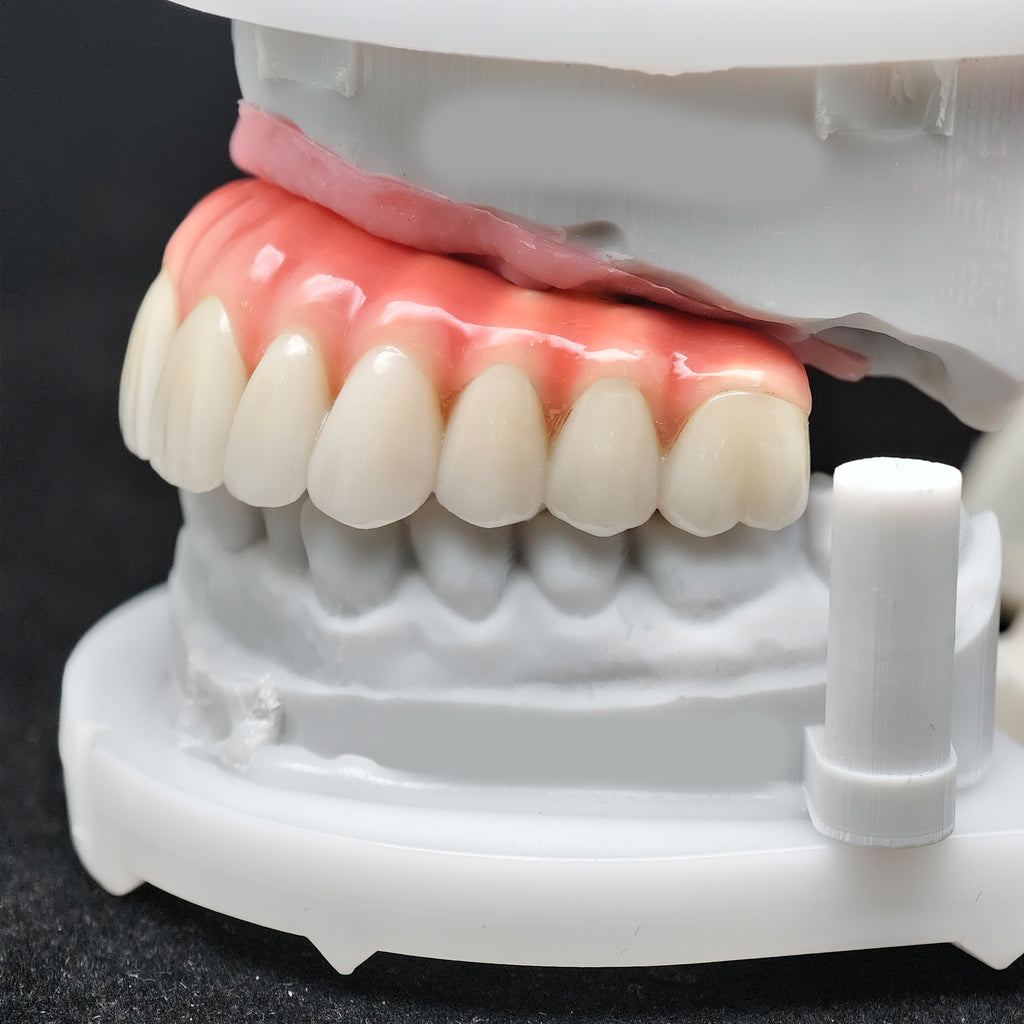 Enhanced Zirconia Crown Malo Bridge
