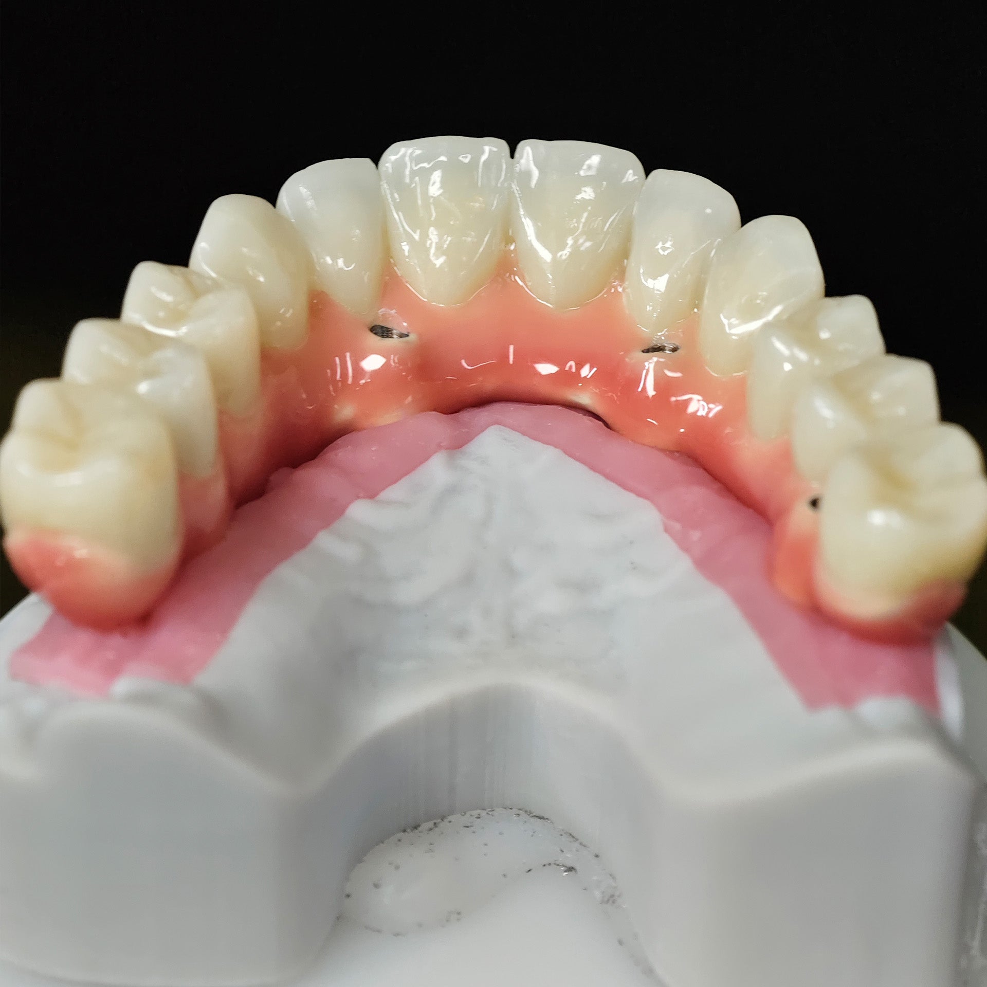 Enhanced Zirconia Crown Malo Bridge