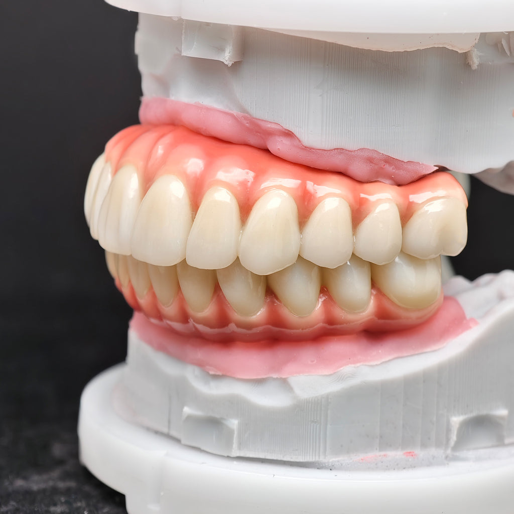 Enhanced Zirconia Crown Malo Bridge