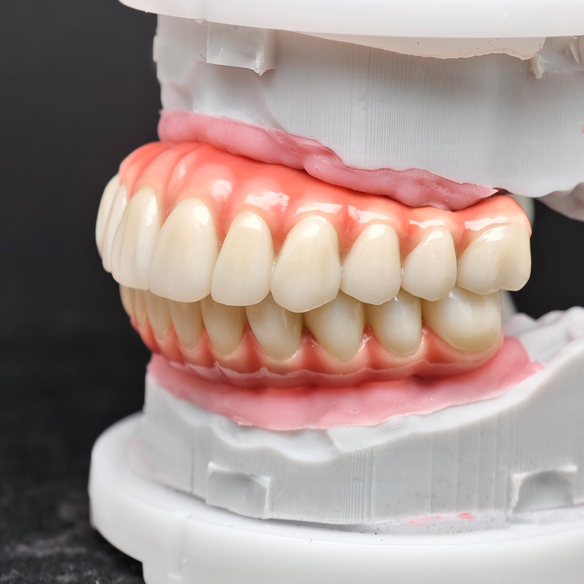 Enhanced Zirconia Crown Malo Bridge