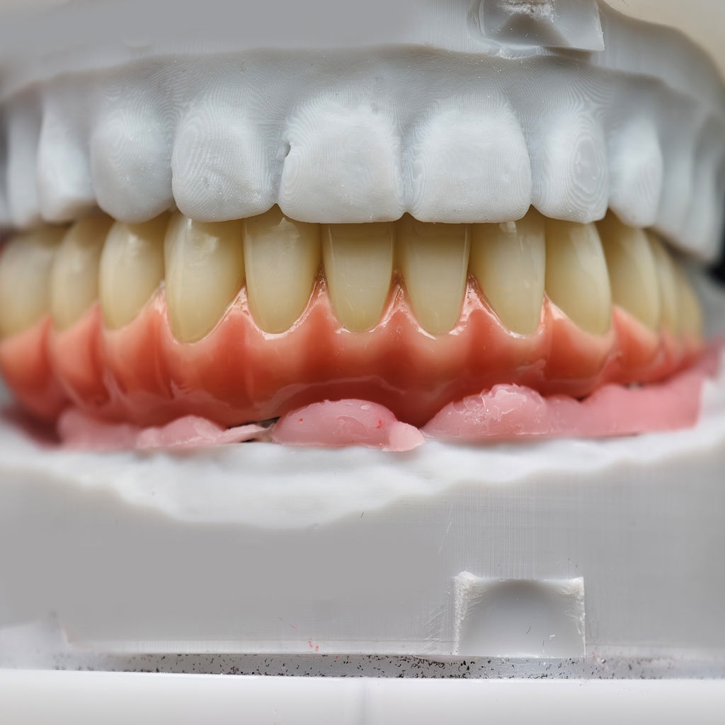 Enhanced Zirconia Crown Malo Bridge