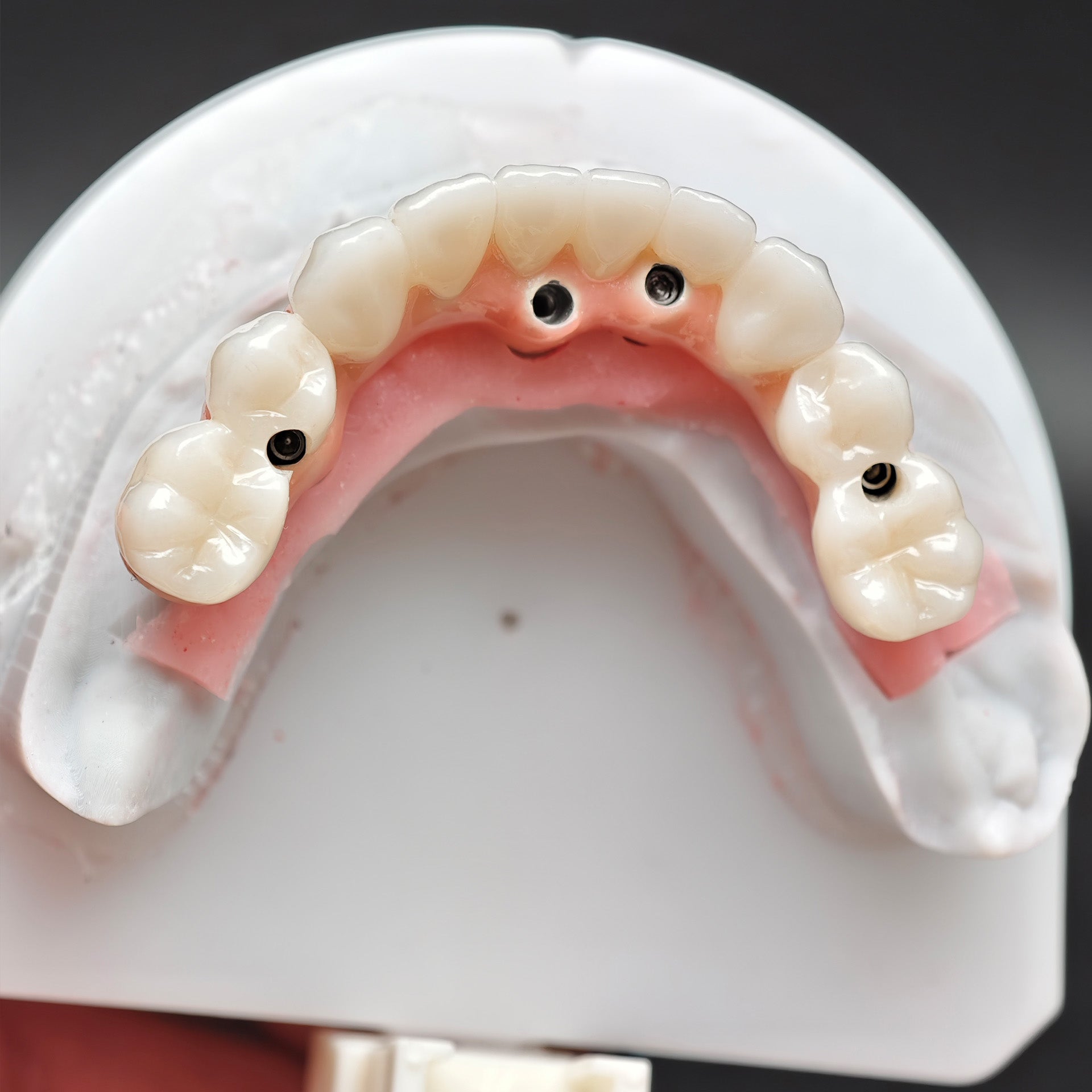 Enhanced Zirconia Crown Malo Bridge