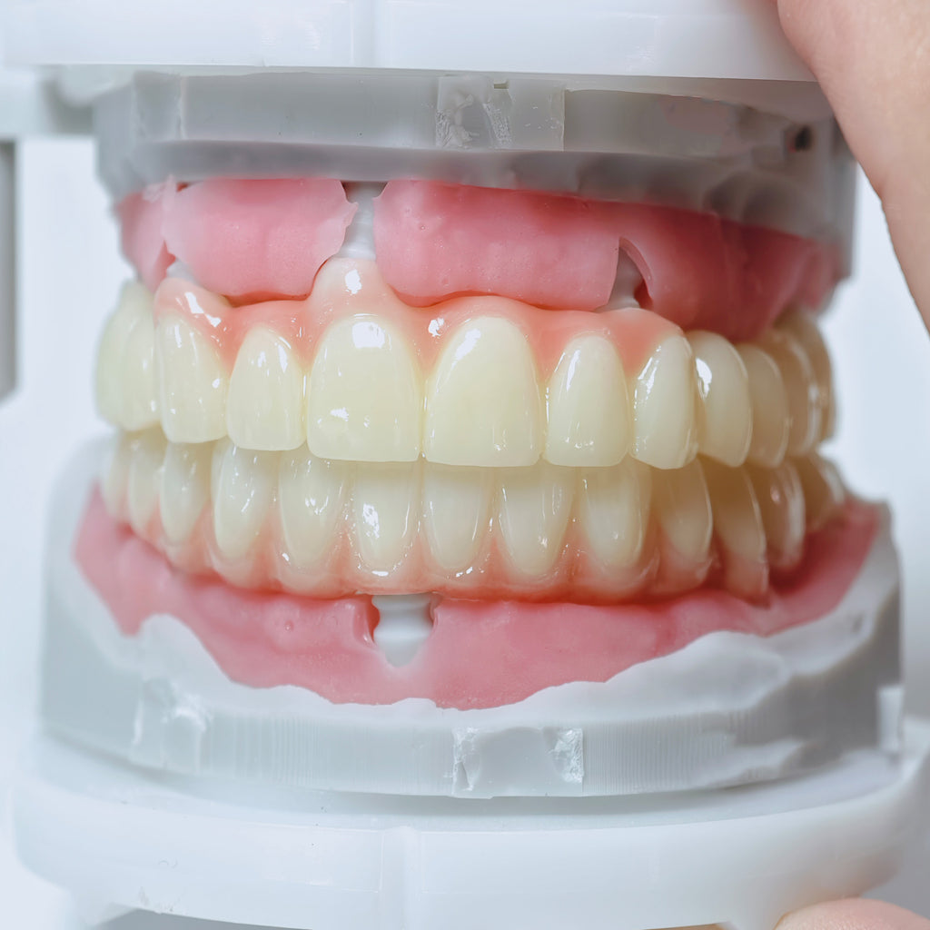 Full-Arch Zirconia Bridge And PMMA Bridge With Cement Retained