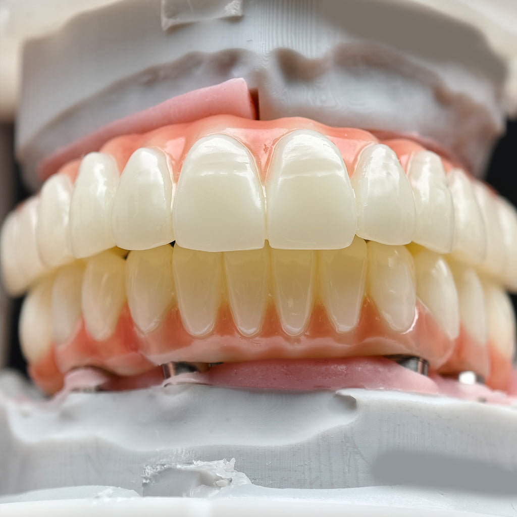 PMMA Bridge With Ti-Base Screw Retained Trying For Full Arch Restoration