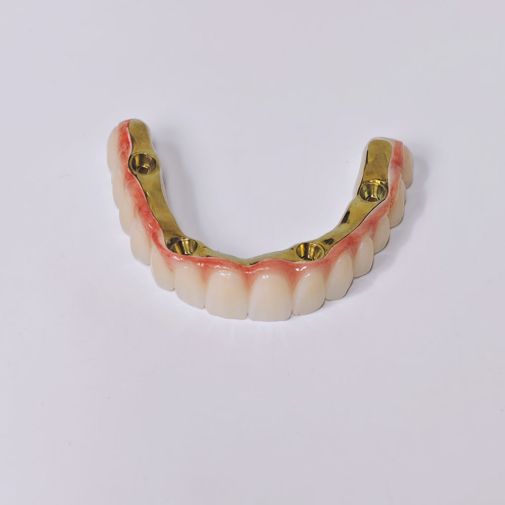 Ti-Bar Titanium Gold-Plated Metal Frame With Zirconia Bridge And Screw Retained
