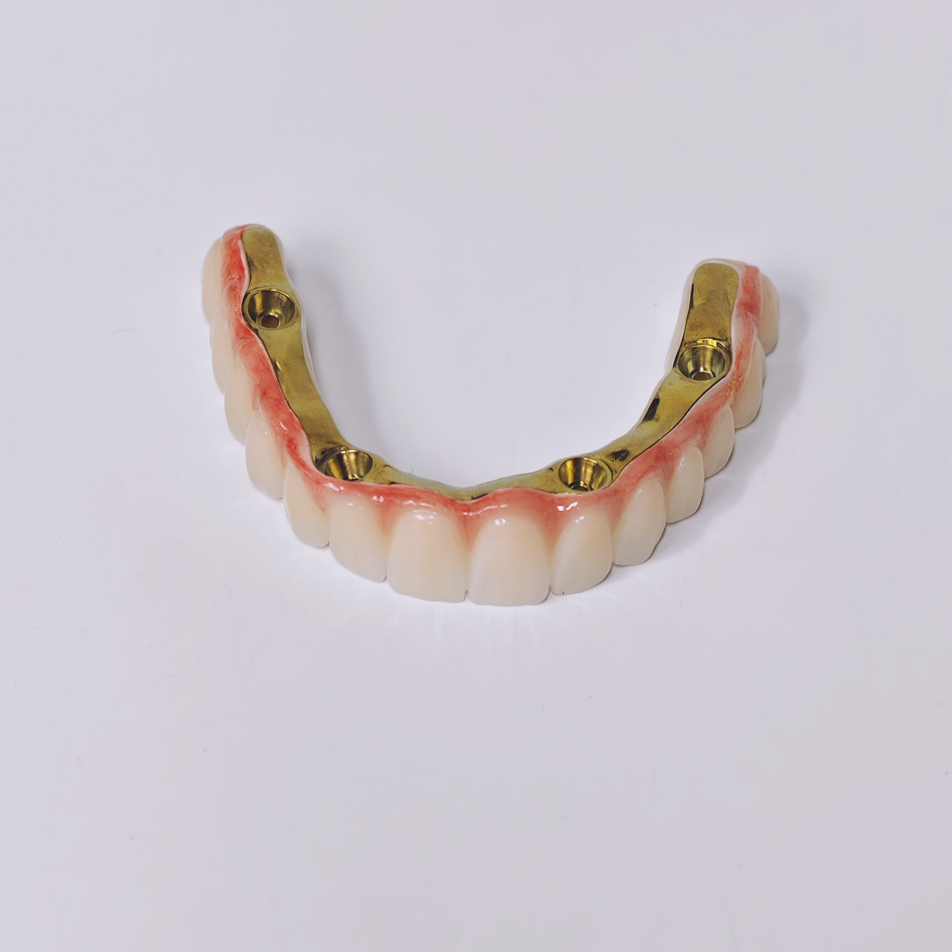 Ti-Bar Titanium Gold-Plated Metal Frame With Zirconia Bridge And Screw Retained